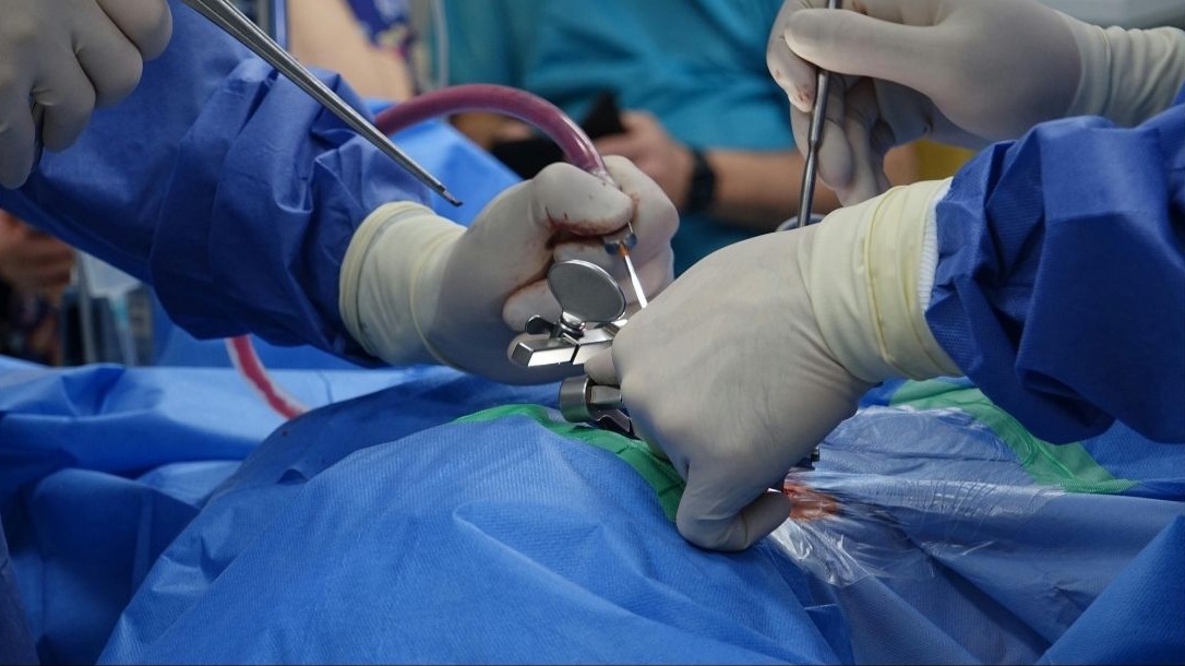 opération chirurgie